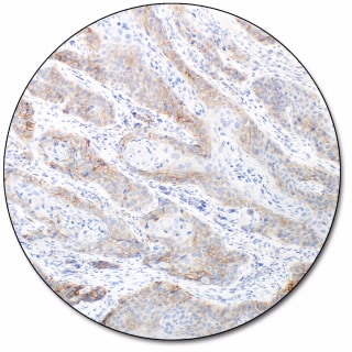 PD-L1 IHC 28-8 pharmDx for Autostainer Link 48